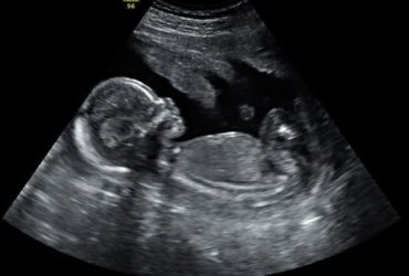 A picture of the inside of an ultrasound.